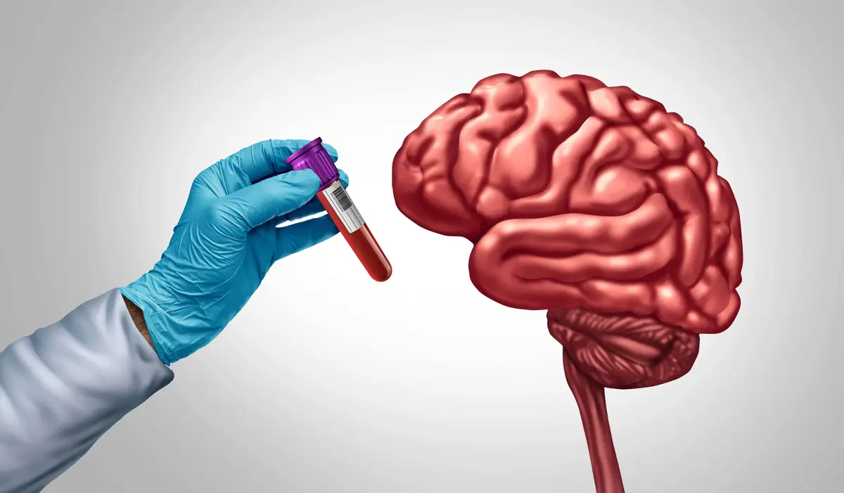 Alzheimer's blood test innovation for early brain health diagnosis.